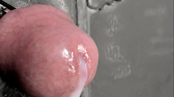 electric stimulation